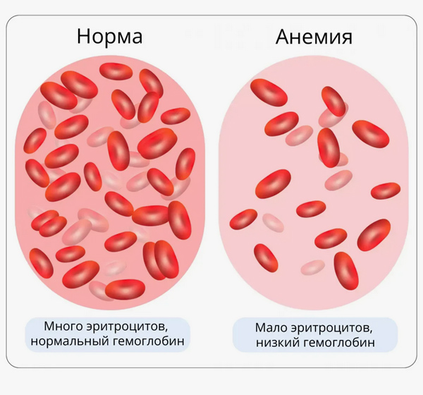гемоглобин